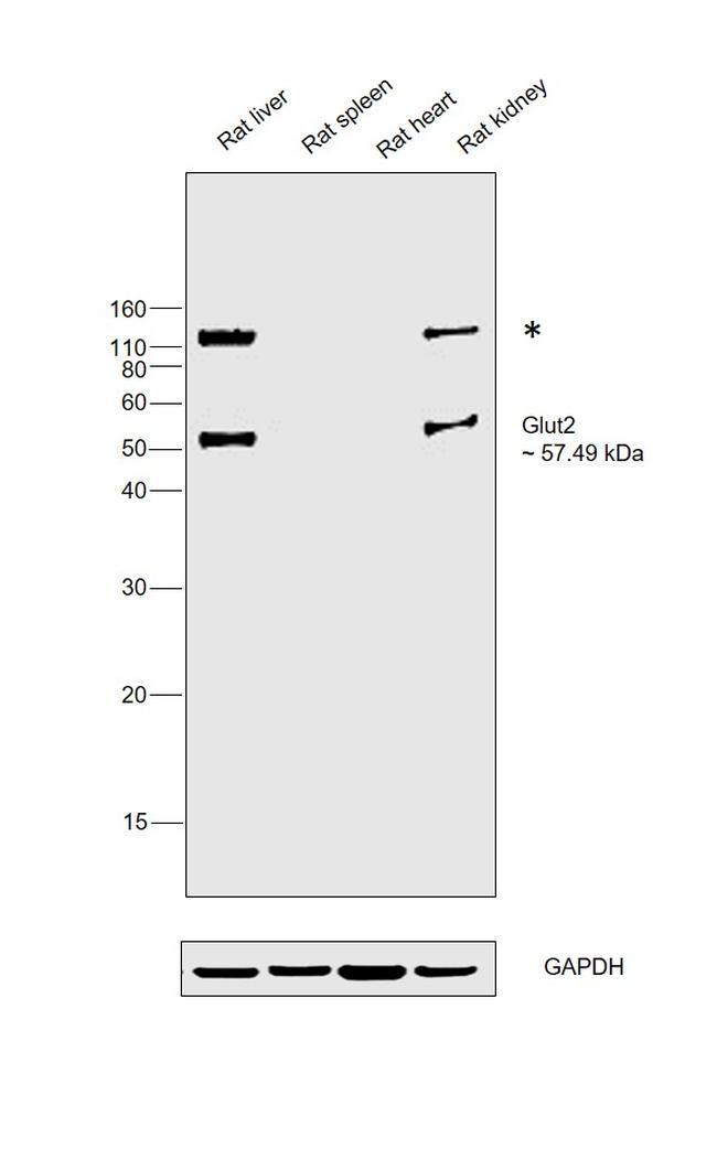 GLUT2 Antibody in Western Blot (WB)