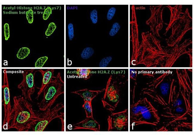 H2A.ZK7ac Antibody