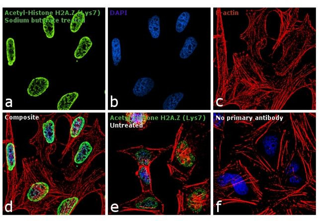 H2A.ZK7ac Antibody in Immunocytochemistry (ICC/IF)