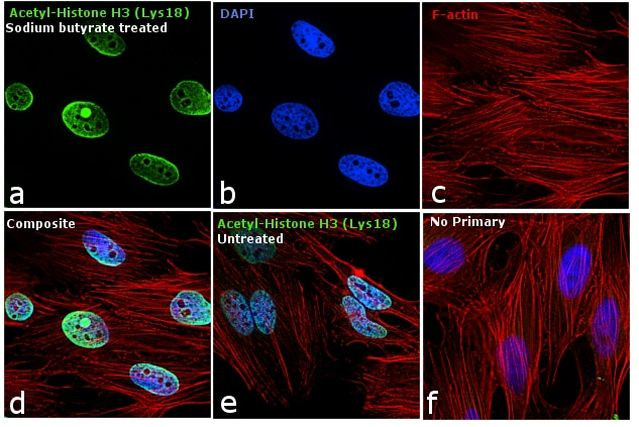 H3K18ac Antibody in Immunocytochemistry (ICC/IF)