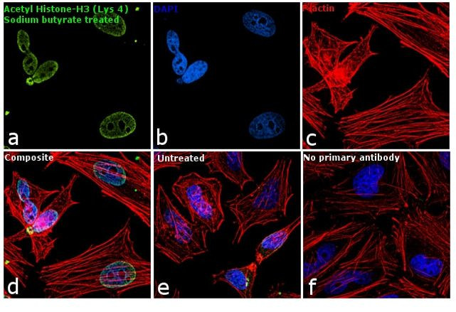 H3K4ac Antibody in Immunocytochemistry (ICC/IF)