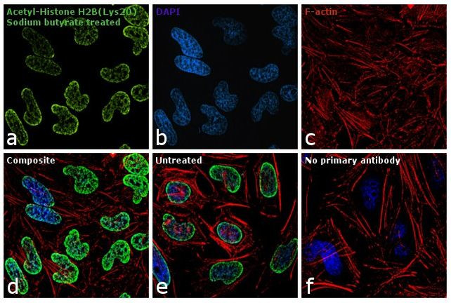 H2BK20ac Antibody in Immunocytochemistry (ICC/IF)