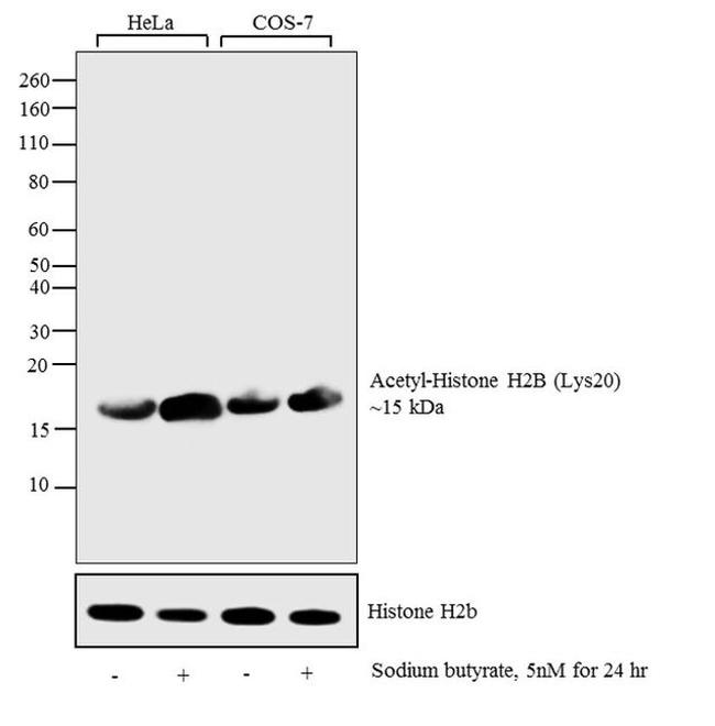 H2BK20ac Antibody in Western Blot (WB)