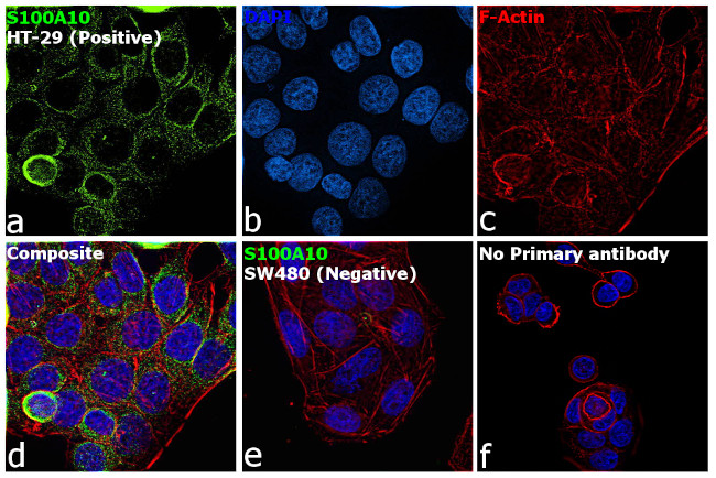 S100A10 Antibody in Immunocytochemistry (ICC/IF)