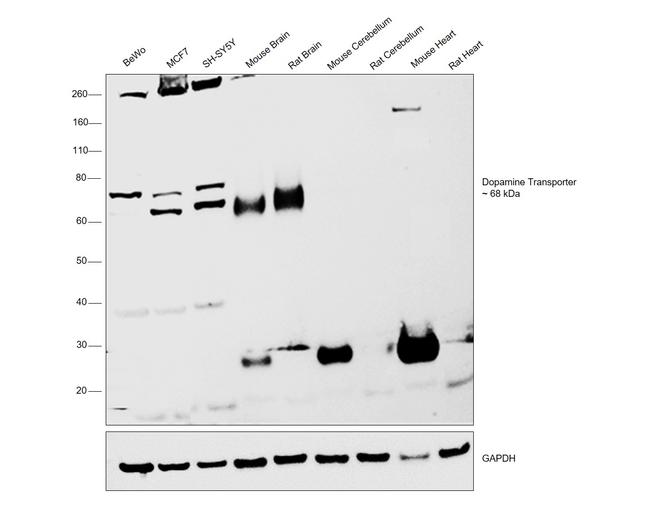 Dopamine Transporter Antibody in Western Blot (WB)