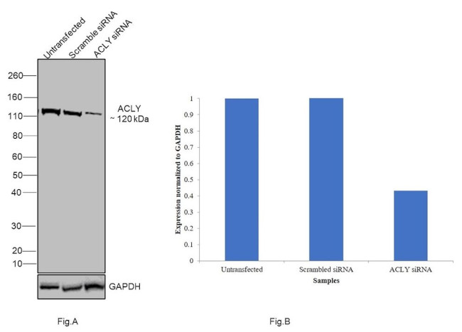 ATP Citrate Lyase Antibody