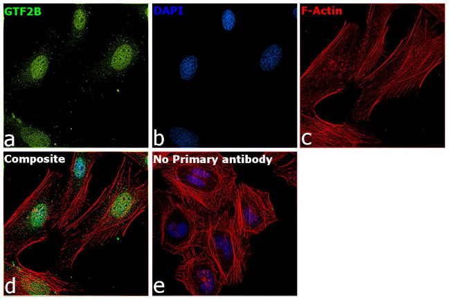 GTF2B Antibody in Immunocytochemistry (ICC/IF)