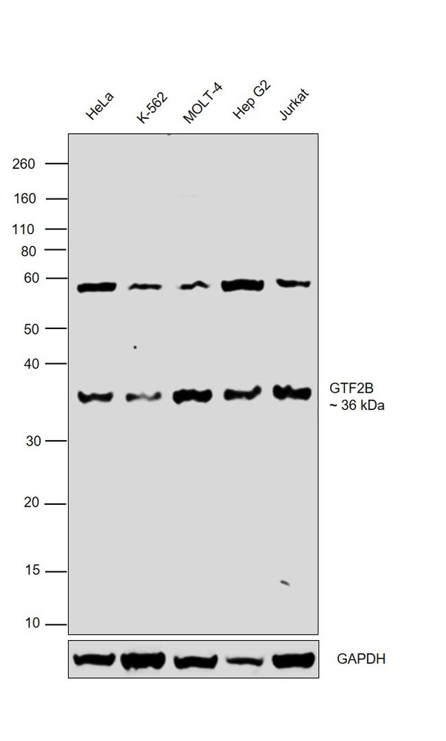 GTF2B Antibody in Western Blot (WB)