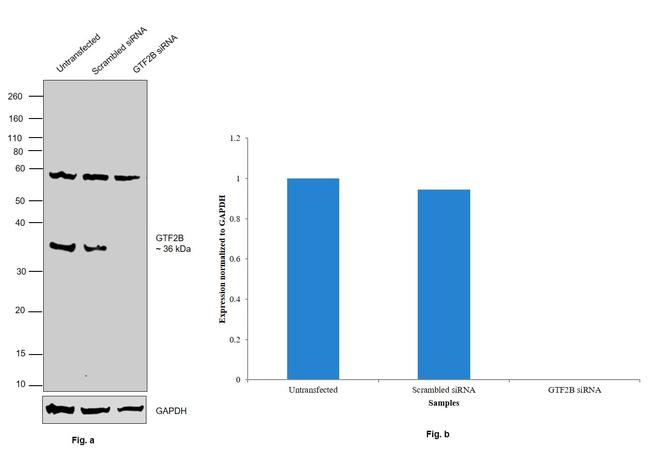 GTF2B Antibody in Western Blot (WB)