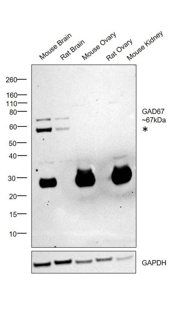 GAD67 Antibody in Western Blot (WB)