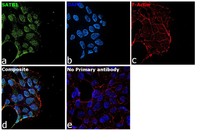 SATB1 Antibody in Immunocytochemistry (ICC/IF)