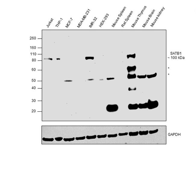 SATB1 Antibody in Western Blot (WB)