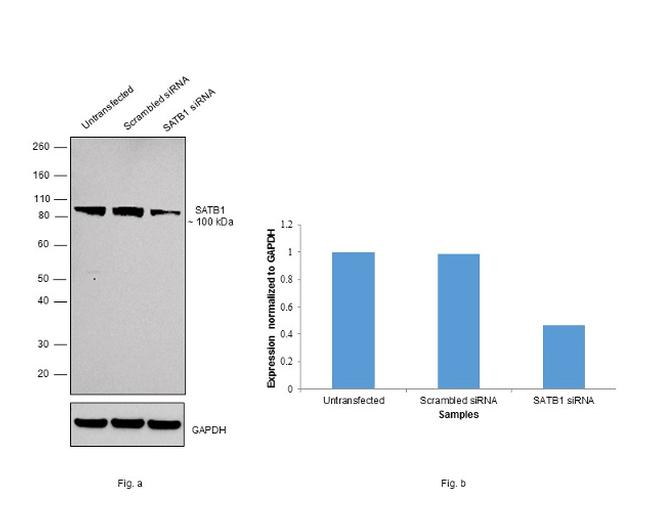 SATB1 Antibody in Western Blot (WB)