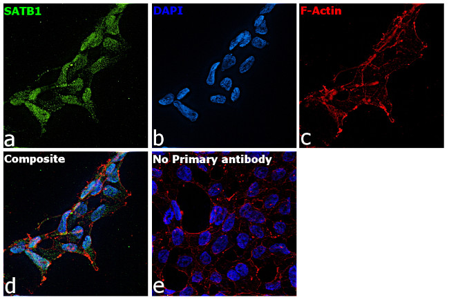 SATB1 Antibody in Immunocytochemistry (ICC/IF)