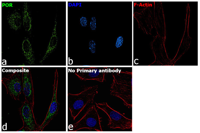 Cytochrome P450 Reductase Antibody in Immunocytochemistry (ICC/IF)