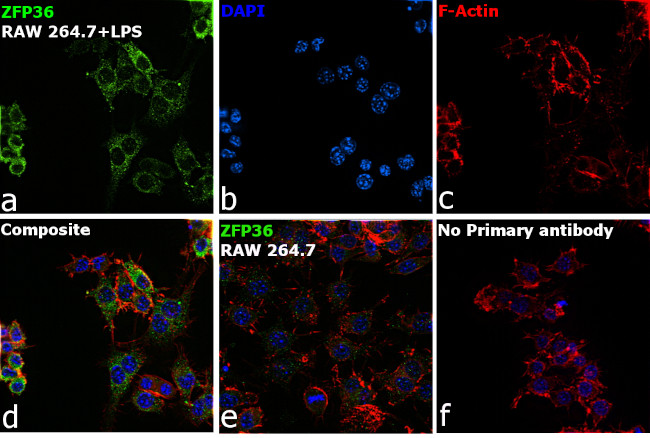 ZFP36 Antibody in Immunocytochemistry (ICC/IF)