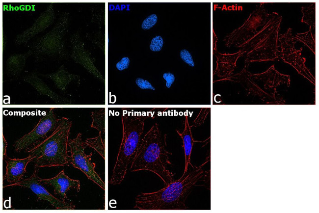 RhoGDI Antibody in Immunocytochemistry (ICC/IF)