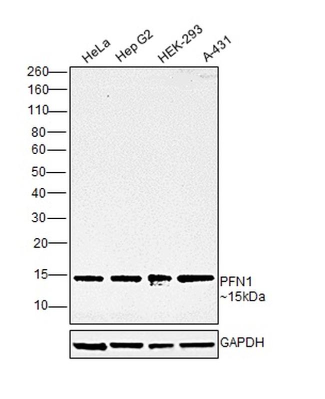 Profilin 1 Antibody in Western Blot (WB)