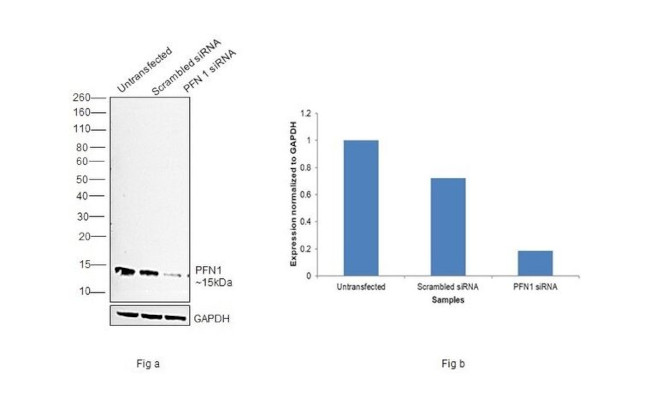 Profilin 1 Antibody