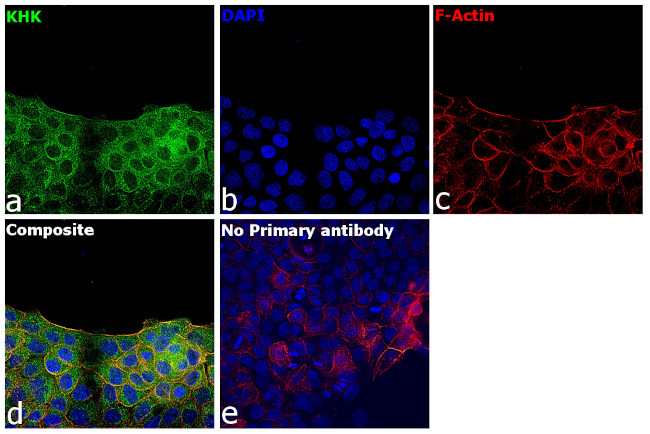 KHK Antibody in Immunocytochemistry (ICC/IF)