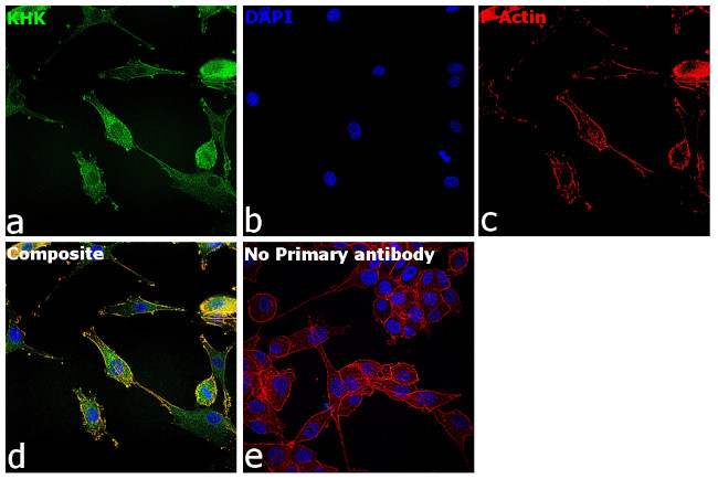 KHK Antibody in Immunocytochemistry (ICC/IF)