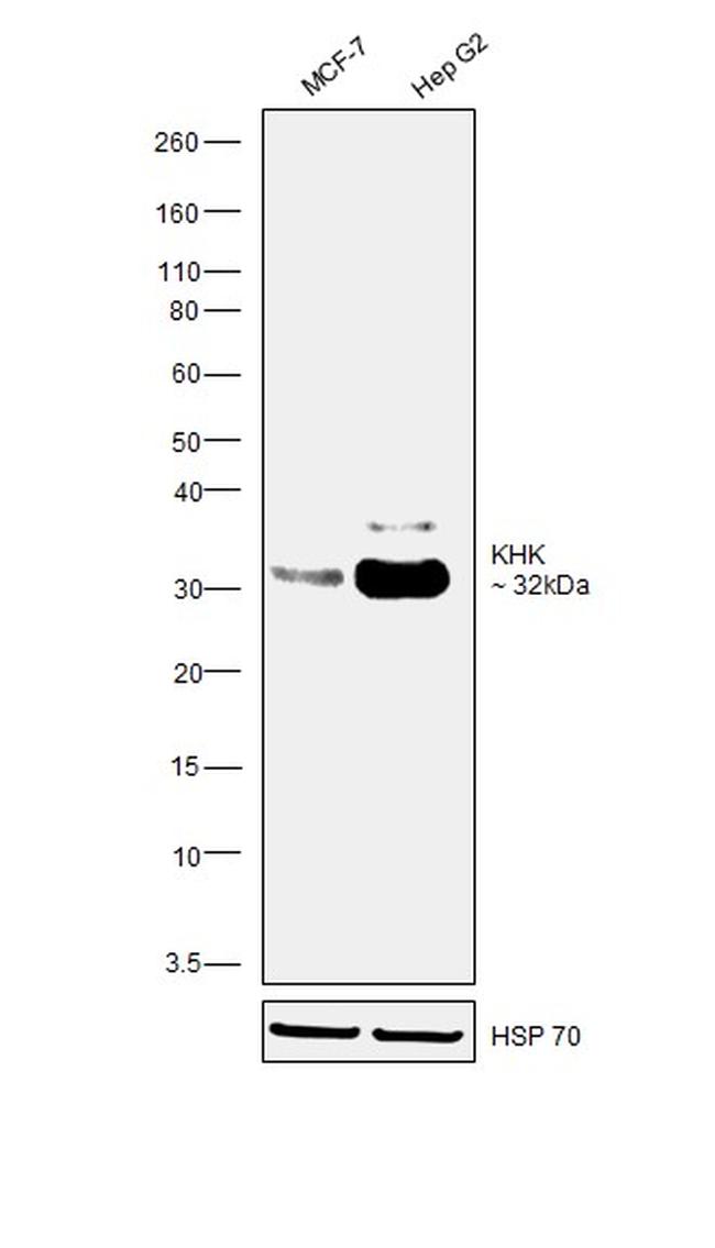 KHK Antibody in Western Blot (WB)