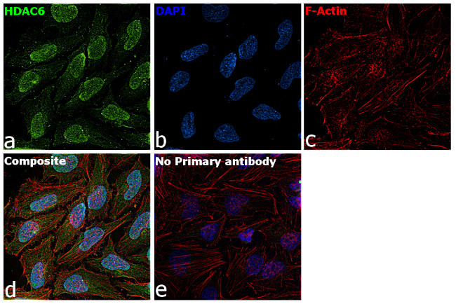 HDAC6 Antibody in Immunocytochemistry (ICC/IF)