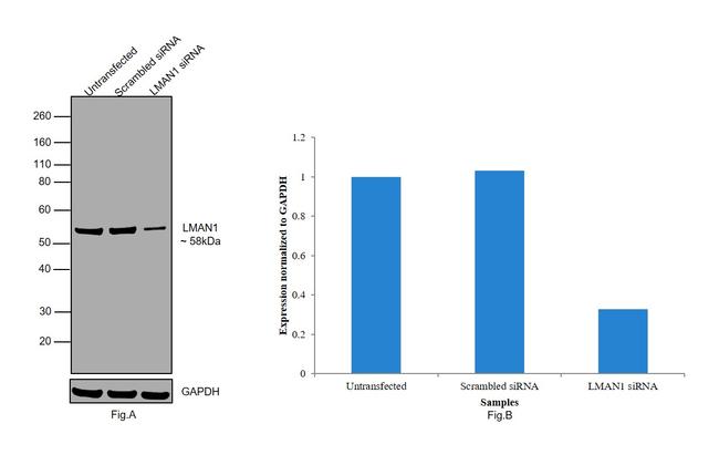 LMAN1 Antibody in Western Blot (WB)