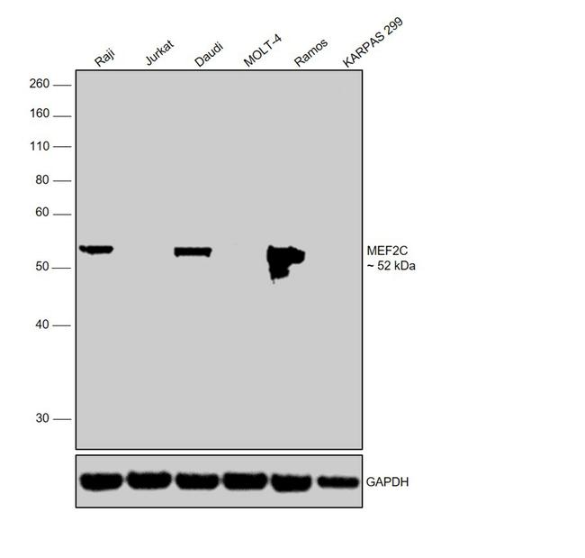 MEF2C Antibody in Western Blot (WB)