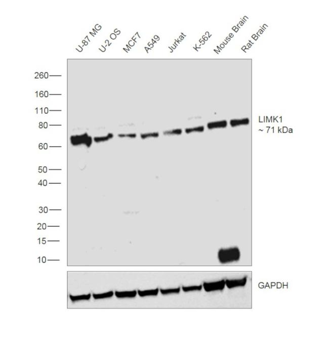 LIMK1 Antibody in Western Blot (WB)