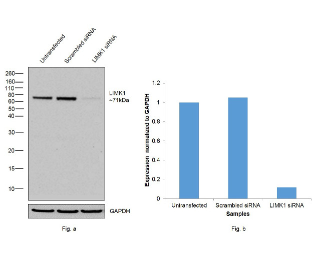 LIMK1 Antibody