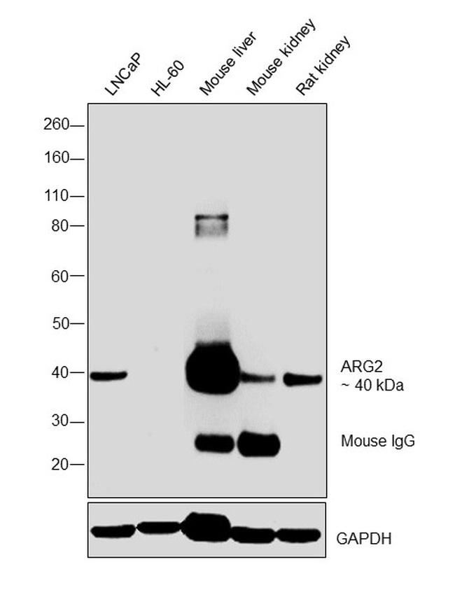 Arginase 2 Antibody in Western Blot (WB)