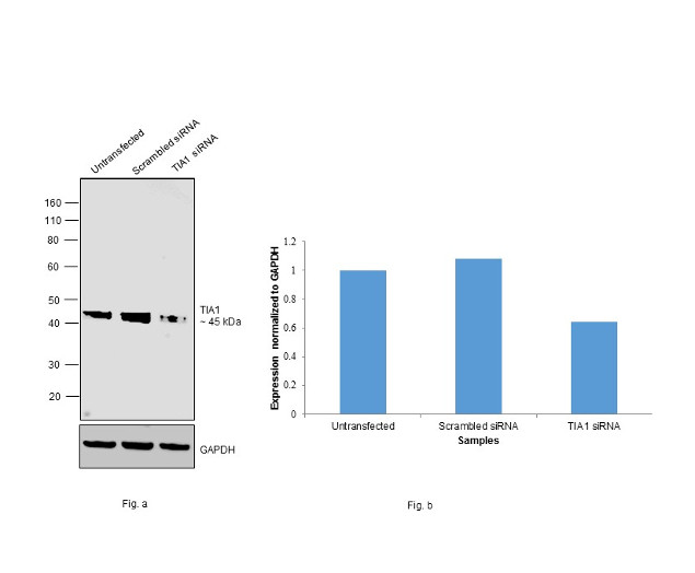 TIA-1 Antibody