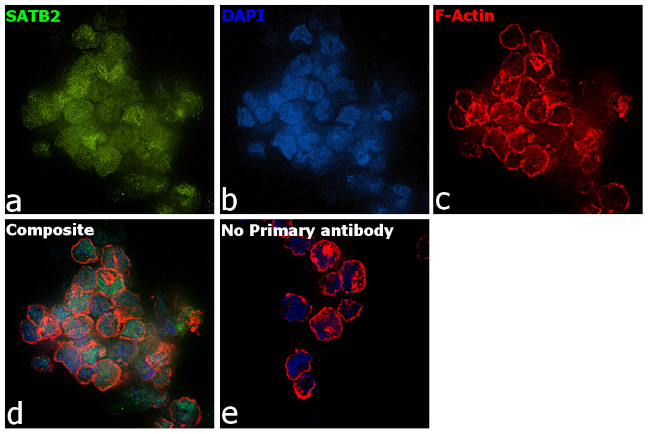 SATB2 Antibody in Immunocytochemistry (ICC/IF)