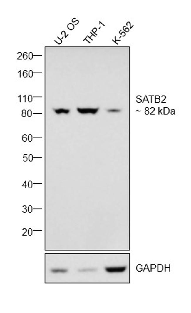 SATB2 Antibody in Western Blot (WB)