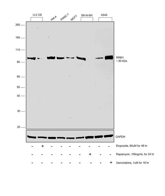 RRM1 Antibody in Western Blot (WB)