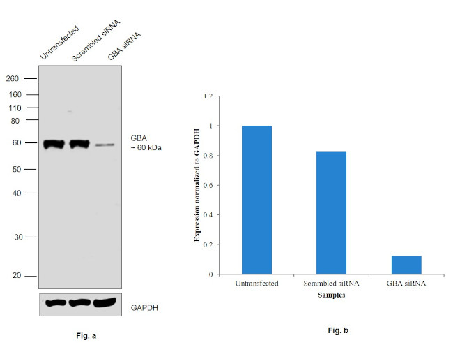 GBA Antibody