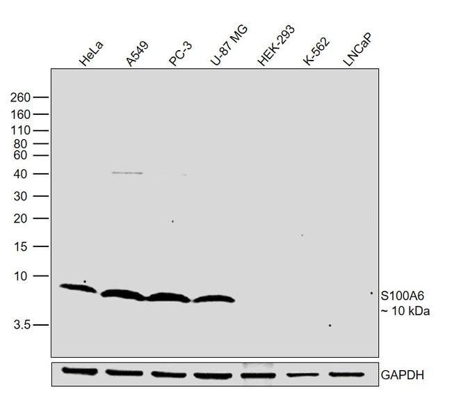 S100A6 Antibody in Western Blot (WB)