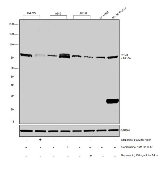 RRM1 Antibody in Western Blot (WB)