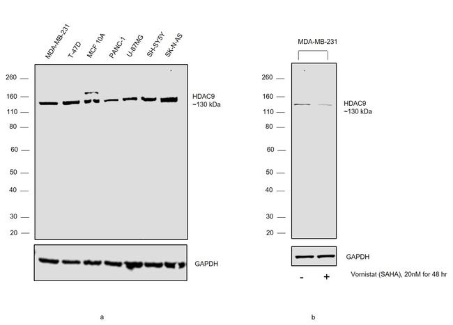 HDAC9 Antibody in Western Blot (WB)