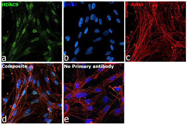 HDAC9 Antibody in Immunocytochemistry (ICC/IF)