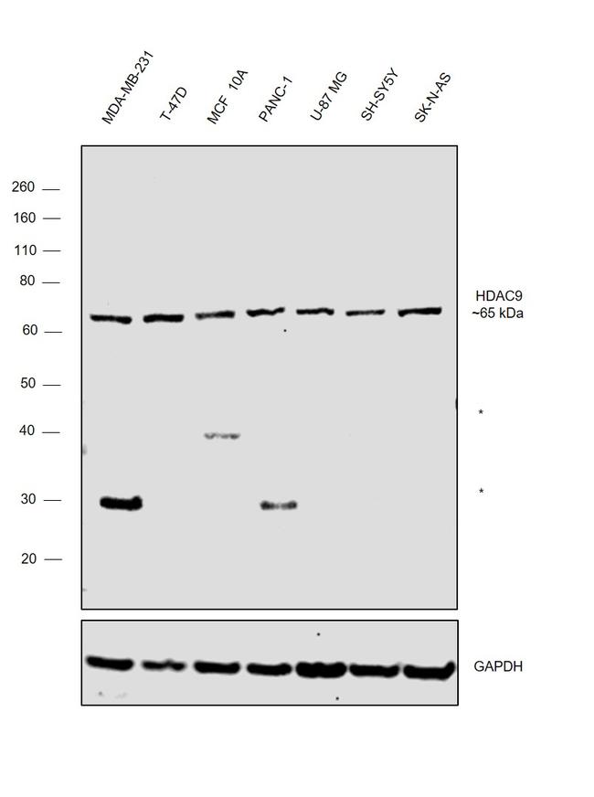 HDAC9 Antibody in Western Blot (WB)