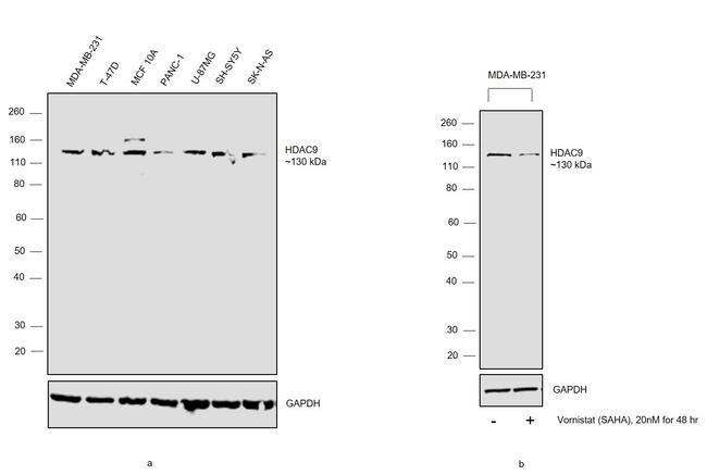 HDAC9 Antibody in Western Blot (WB)