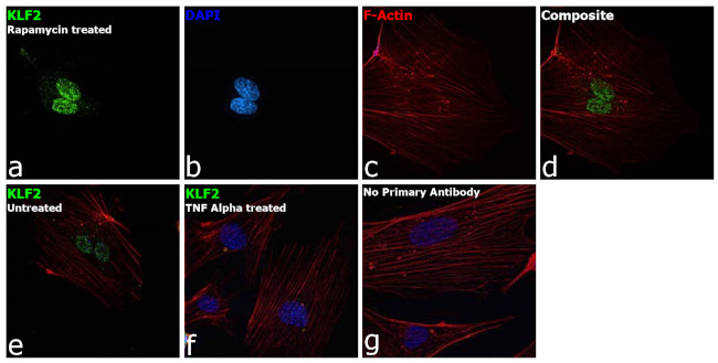 KLF2 Antibody in Immunocytochemistry (ICC/IF)