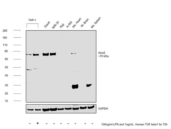 ALOX5 Antibody in Western Blot (WB)