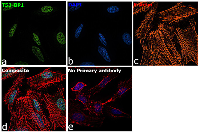 53BP1 Antibody in Immunocytochemistry (ICC/IF)