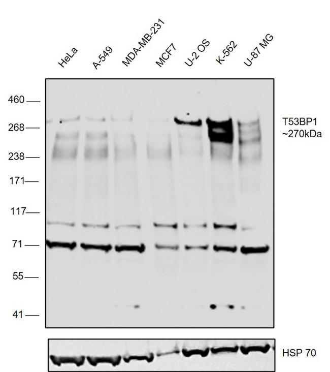 53BP1 Antibody in Western Blot (WB)