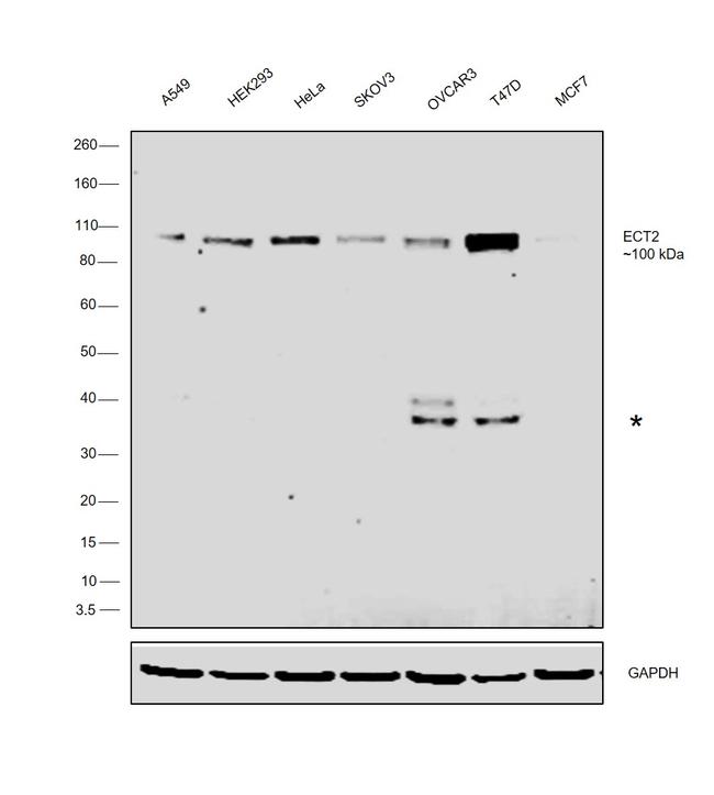 ECT2 Antibody in Western Blot (WB)