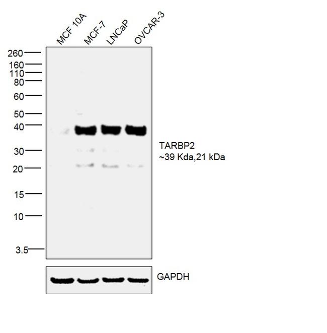 TRBP Antibody in Western Blot (WB)