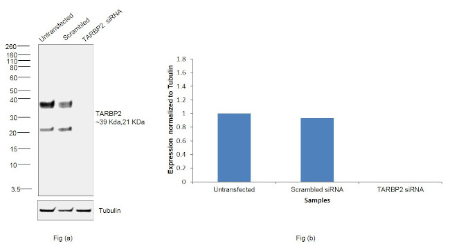 TRBP Antibody